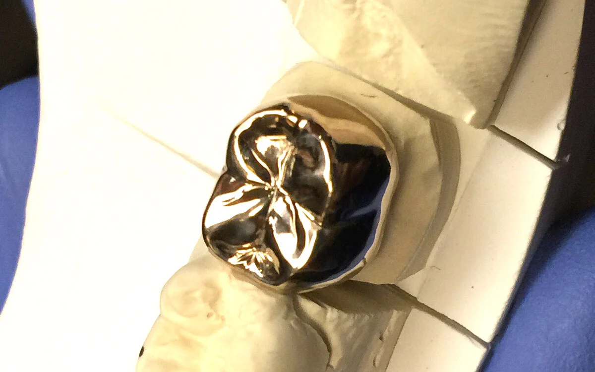 zahngold